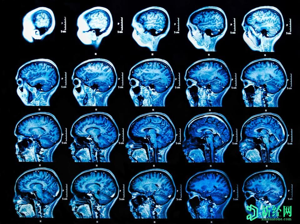 人工智能將改變醫(yī)療保健的3種方式