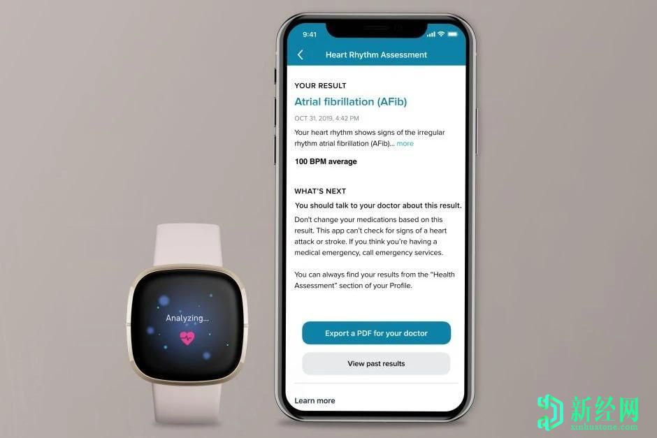 熱門的新Fitbit Sense智能手表最好的東西今年可以使用